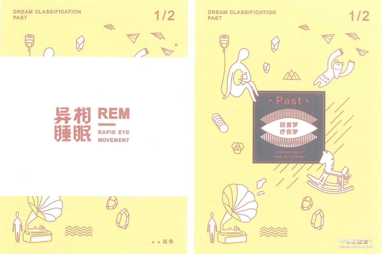 异相睡眠